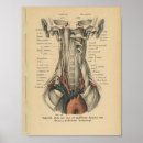 Search for aortic Medical