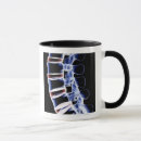 Search for vertebrae mugs Human body part