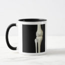 Search for knee mugs Medical