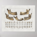 Recherche de dentiste vintage posters Médical