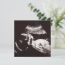 Search for ultrasound baby shower invitations Picture