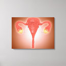 Search for female anatomy canvas prints Healthcare