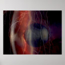 Recherche de opticien posters Ophtalmologue