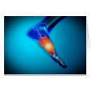 Recherche de achilles cartes postales Orteil