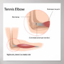 Search for pain posters Sports