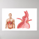 Search for medical diagram posters Body