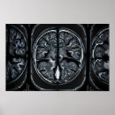 Recherche de neurosciences posters Anatomie