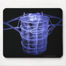 Search for artery electronics Part