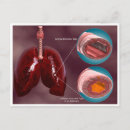 Search for lung postcards Medicine