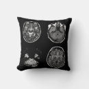 Search for brain pillows Anatomy