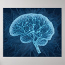 Recherche de neuronal art Cerveau