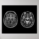 Recherche de neurosciences posters Anatomie