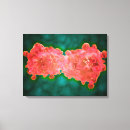 Recherche de pathologie art Oncologie