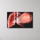 Search for attack canvas prints Horizontal
