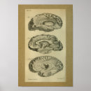 Recherche de lobes posters Anatomie