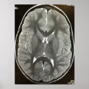 Search for brain posters Head