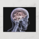 Search for brain postcards Skull
