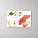 Search for remove art Removing