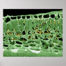 Search for electron micrography posters Close up view