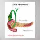 Recherche de pancréatite Pancréatique