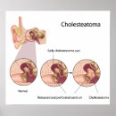 Recherche de tumeur posters Anatomie
