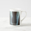 Search for broken bone mugs Funny