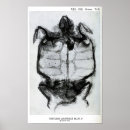 Recherche de rayons x posters Médical