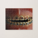 Search for dental puzzles Horizontal