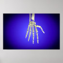 Recherche de dorsaux posters Distal