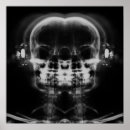 Search for x ray skeleton art Skeletons