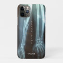 Search for funny bone iphone cases Humour
