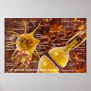 Recherche de neurones posters Médecine