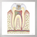 Recherche de illustration dentaire posters Médical