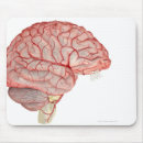 Search for artery electronics People