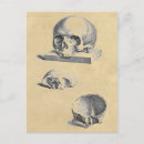Recherche de crâne humain cartes postales Anatomie
