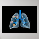 Recherche de cavité posters Illustrations biomédicales