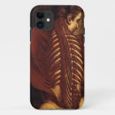Search for medical illustration iphone cases Vintage