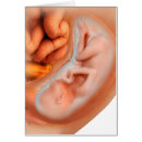 Recherche de foetus cartes postales Reproduction