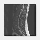 Recherche de mri Chirurgie