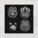 Recherche de cérébral cartes visite Médical