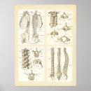 Recherche de spine posters Chiropractic