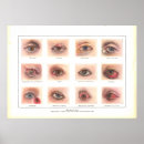 Recherche de un oeil posters Médical