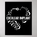 Search for implants posters Asl