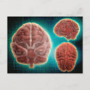 Recherche de lobe cartes postales Neuroanatomie