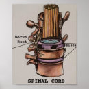Recherche de vertébral posters Doctor