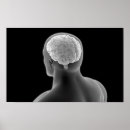 Recherche de sensoriel art Médecine