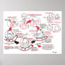 Recherche de anatomie poumon art Médecine