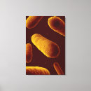 Recherche de pathologie art Recherche