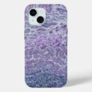 Search for sea foam iphone cases Abstract