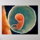 Recherche de embryon posters Médical